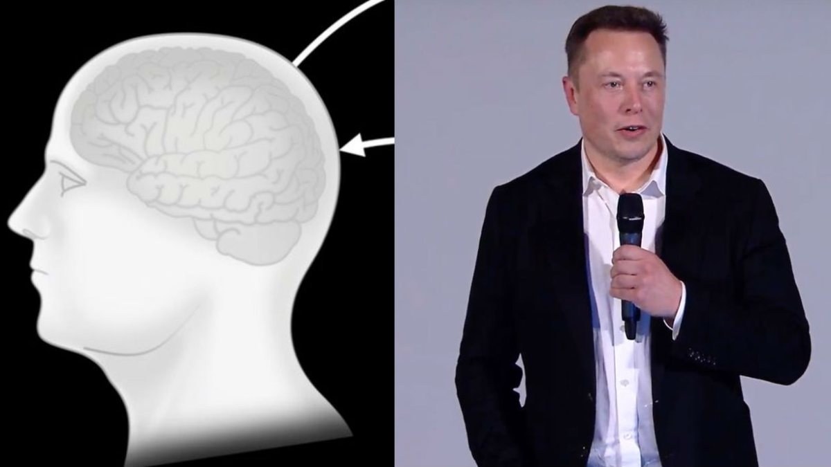 Elon Musk, 28 Ağustos'ta çalışan bir Neuralink cihazı gösterecek