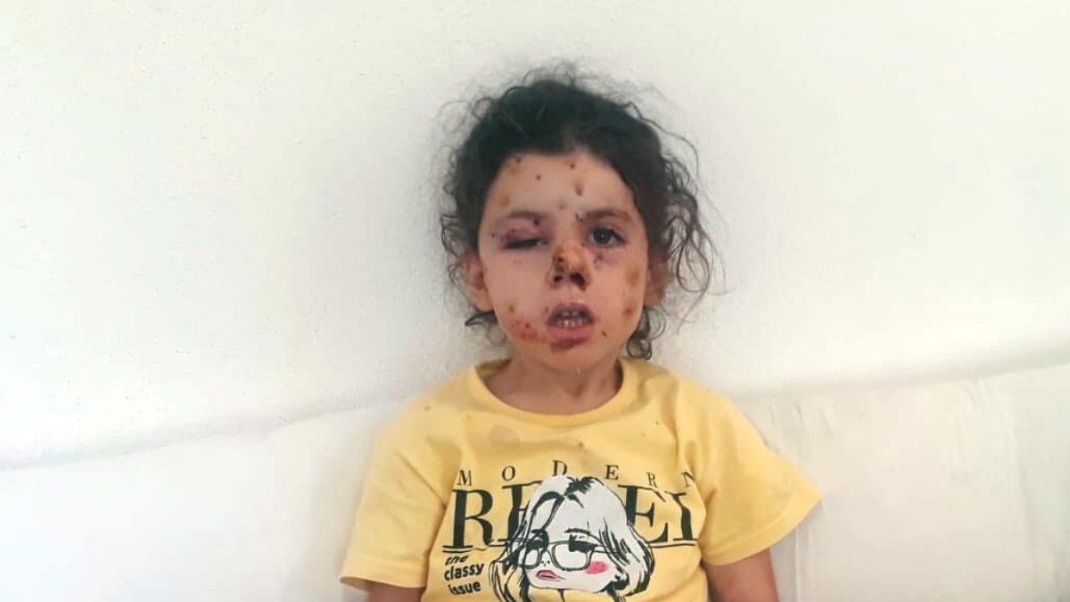İzmir'de düğün konvoyunda ateş açıldı, 5 yaşındaki çocuk yaralandı