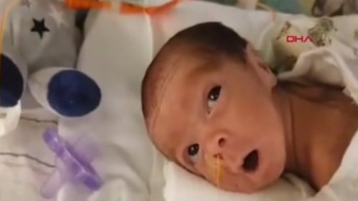 ABD'de korona hastası hamile kadın, entübe halde doğum yaptı