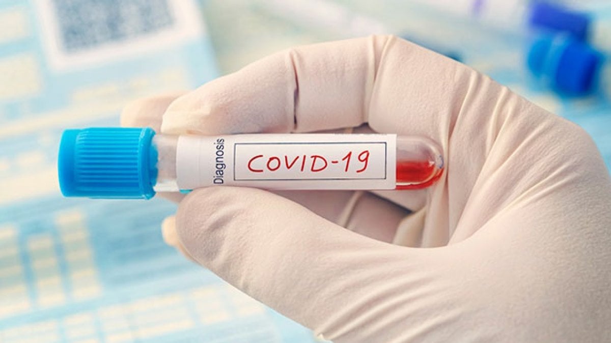 Bilim insanları, bazı kan gruplarının koronavirüse karşı daha dirençli olduğunu tespit etti