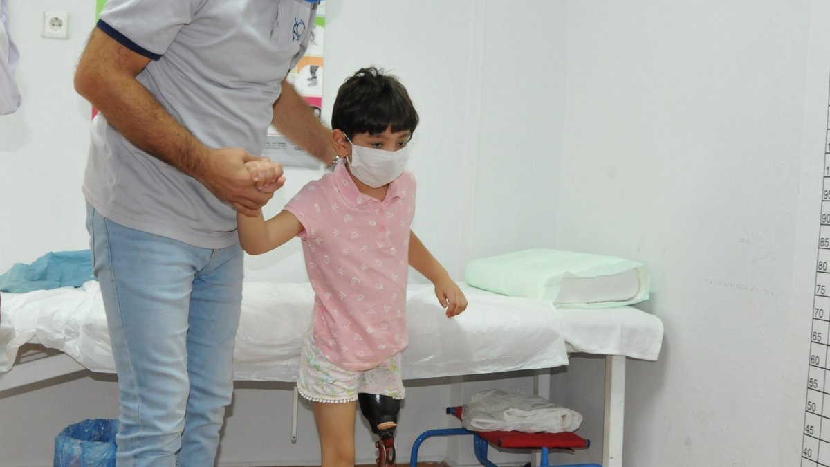 Antalya'da bacağı kesilen Özge’ye silikonlu protez için 30 bin TL gerekiyor