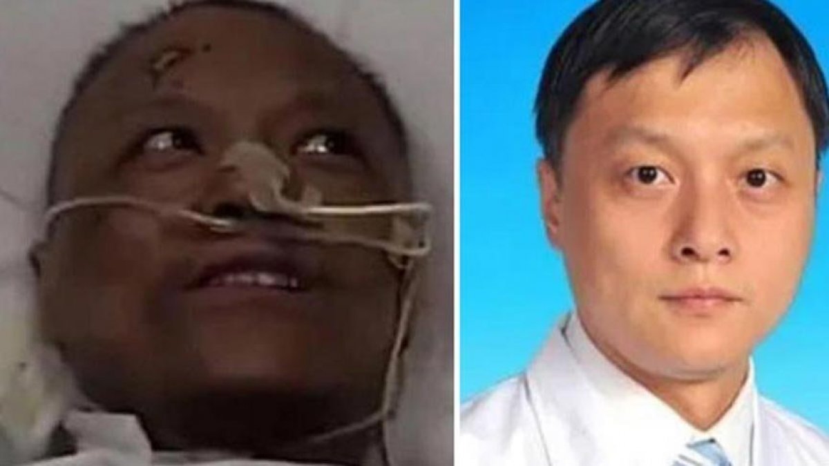 Koronavirüs sonrası ten rengi değişen Çinli doktor normale döndü