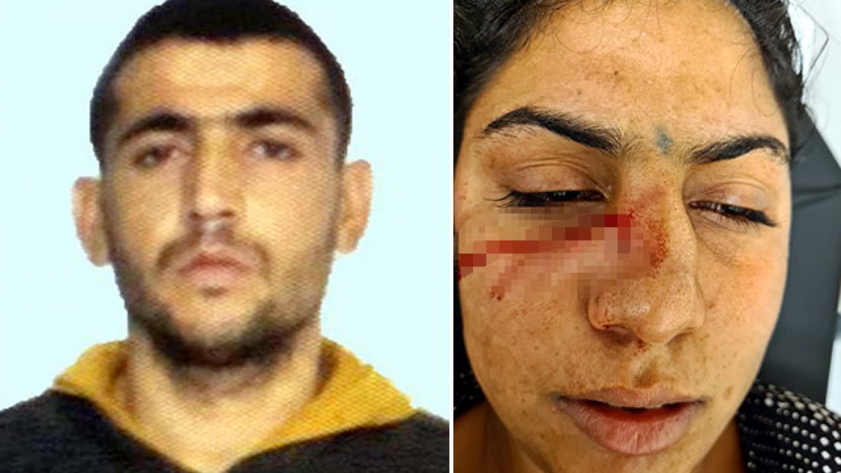 Adana'da dini nikahlı eşini darbedip bıçaklayan koca tutuklandı