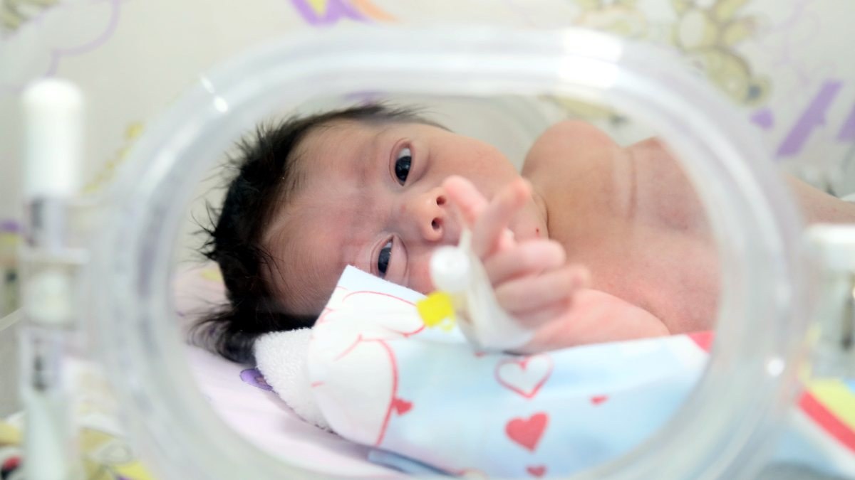 Antalya'da tüm iç organları ters olan bebek doğdu