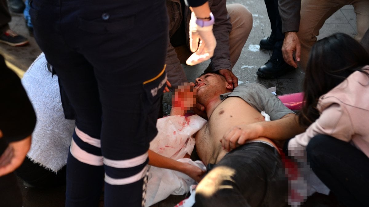 Adana'da çıkan kavgada 2 kardeş yaralandı
