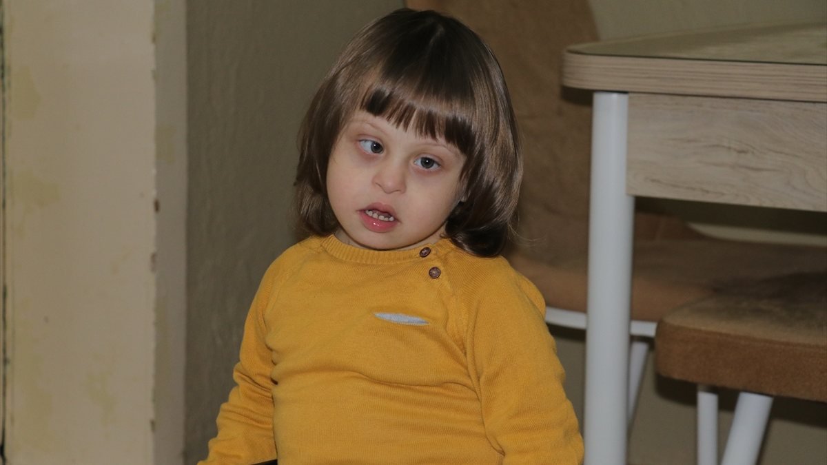 Yozgat'ta down sendromlu lösemi hastası Umut, tedavisine destek bekliyor