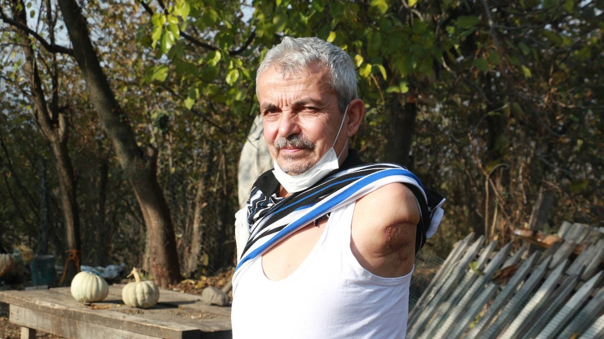 Samsun'da kolunu makineye kaptıran çiftçi, protez kol istiyor