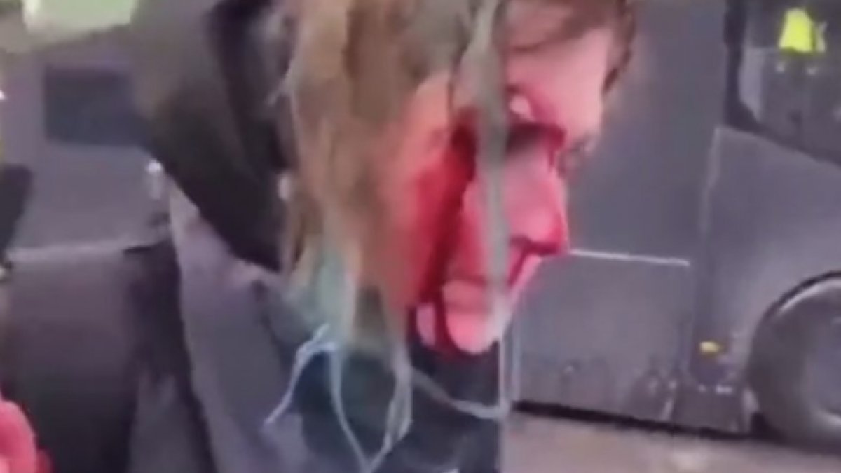 Hollanda’da tazyikli su sıkılan kadın yaralandı