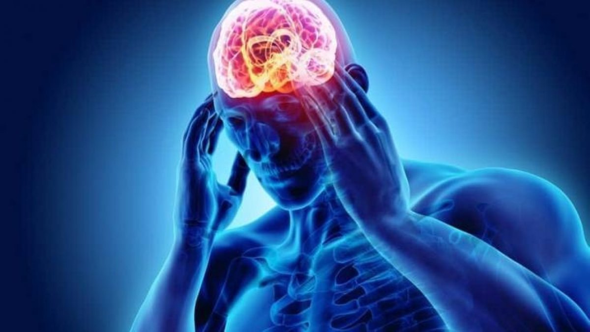 Beyin tümörü nedir, belirtileri nelerdir? Beyin tümörü nasıl anlaşılır, tedavisi var mı?