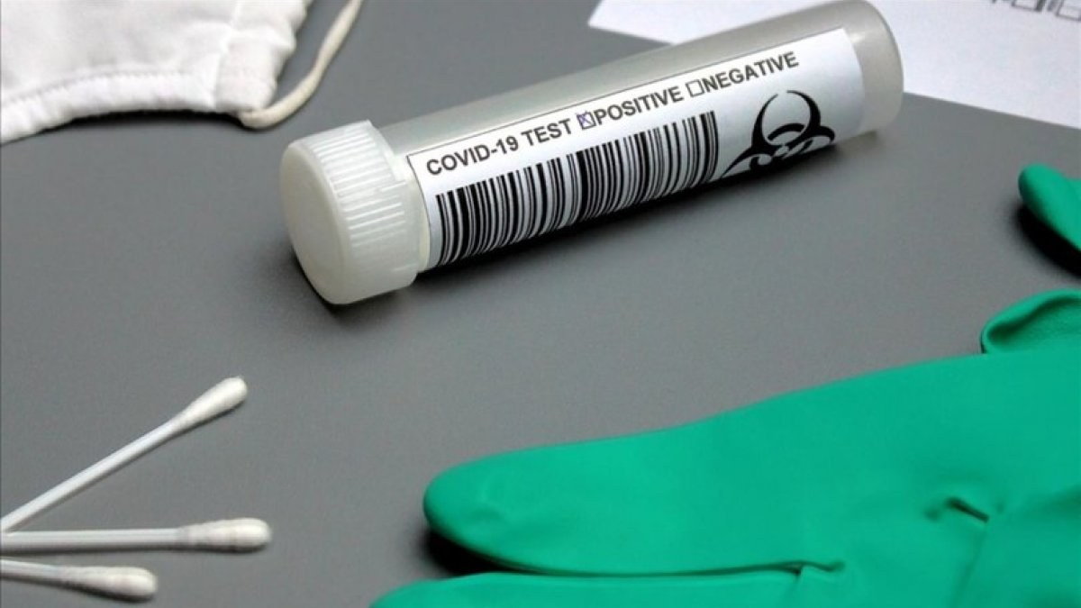 Tokyo hükümetinden Pekin'e: Anal koronavirüs testi istemiyoruz