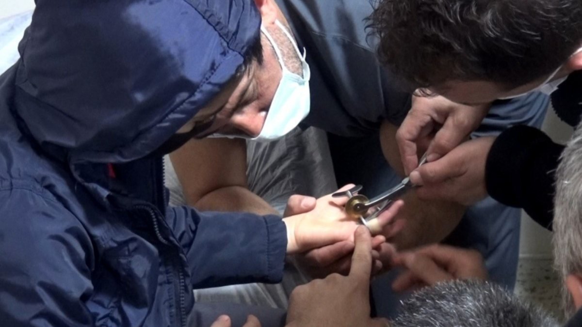 Erzincan'da çocuğun parmağına metal parça sıkıştı