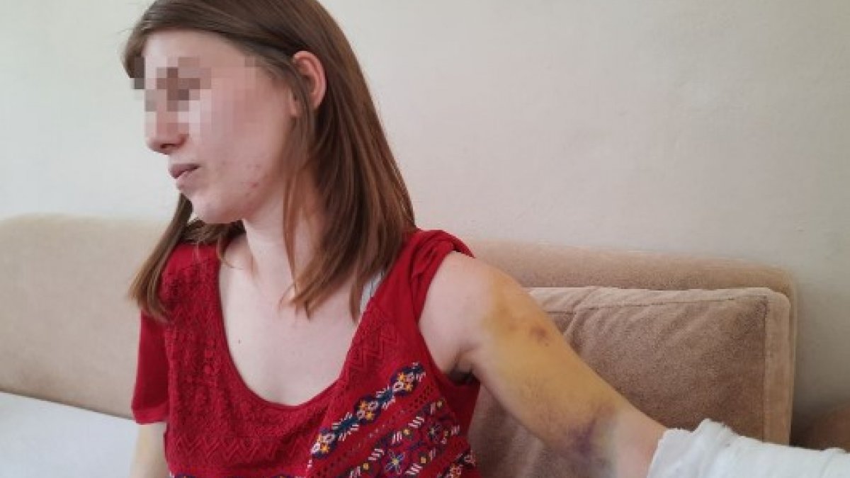Beyzbol sopasıyla öldüresiye dövülen genç kadın: Öleceğimi sandım