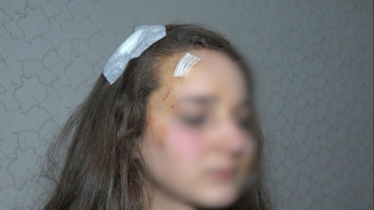 Bursa'da başkasına benzettiği kıza saldırdı