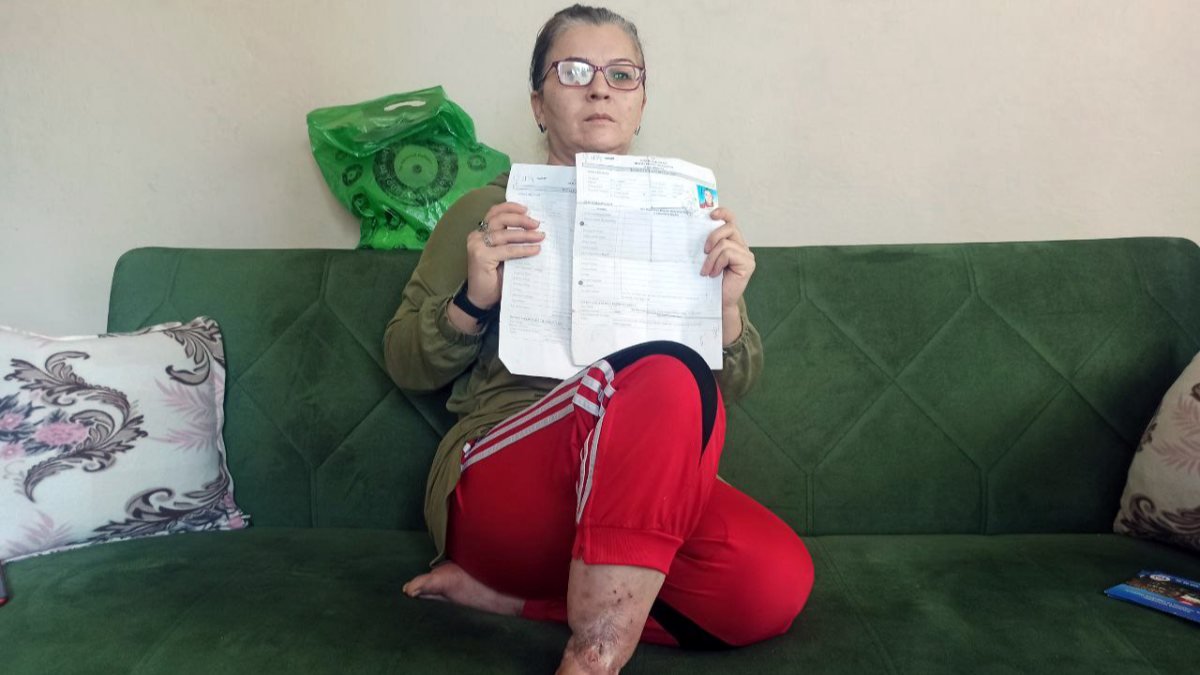 Mersin'de vücuduna iltihap yayılan kadın yardım bekliyor