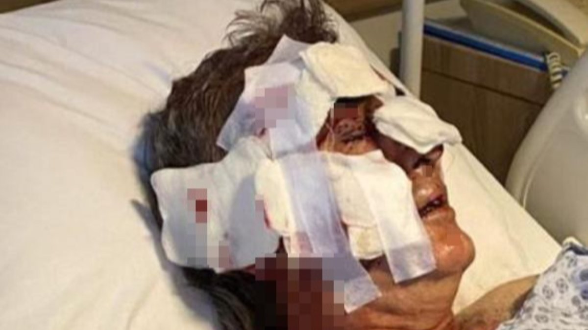 Antalya'da otel çalışanına maymun saldırdı