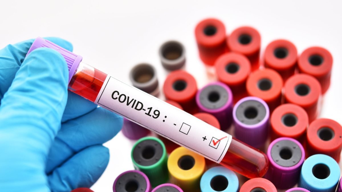 Kan grupları COVID-19 riskini etkilemiyor