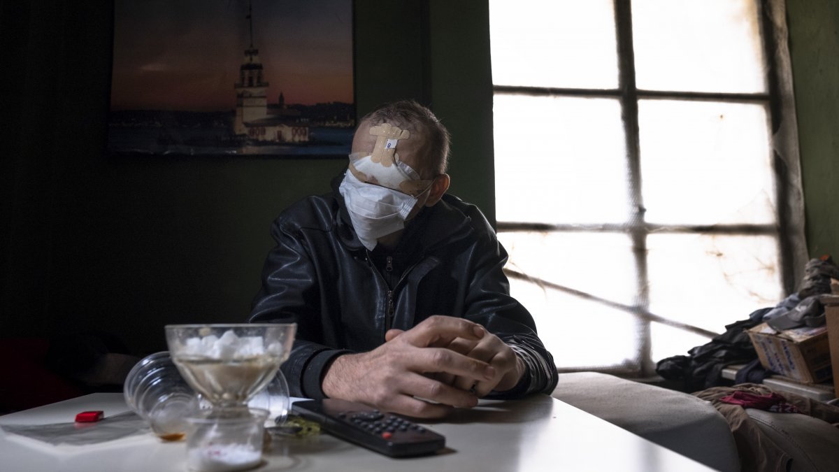 Konya'da cilt kanseri nedeniyle yüzünü kaybetti, hayatı kabusa döndü