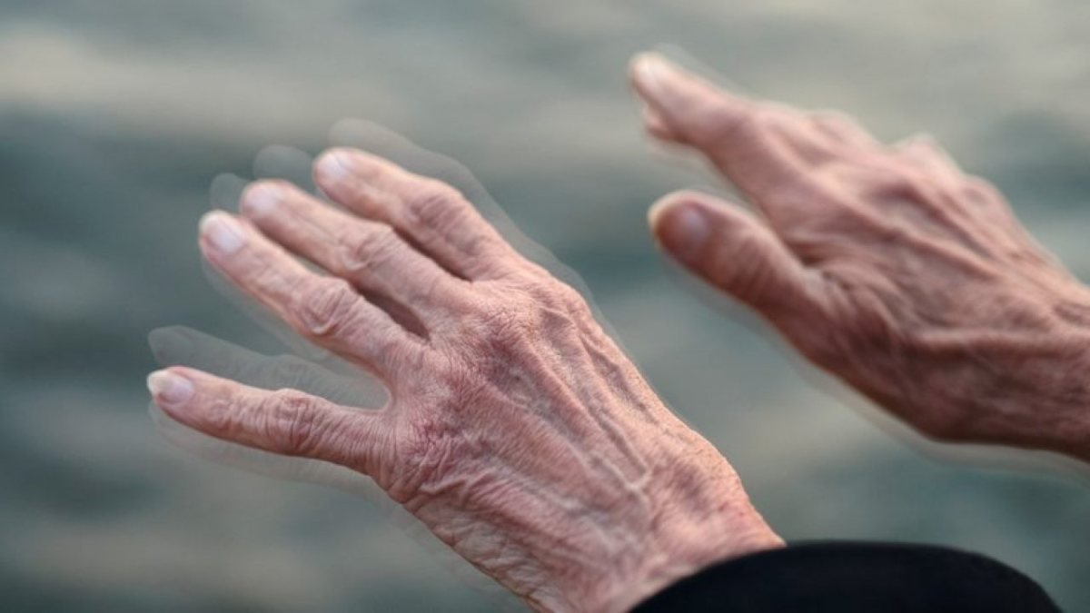 Parkinson Hastalığının Dikkat Edilmesi Gereken 23 Belirtisi 5562