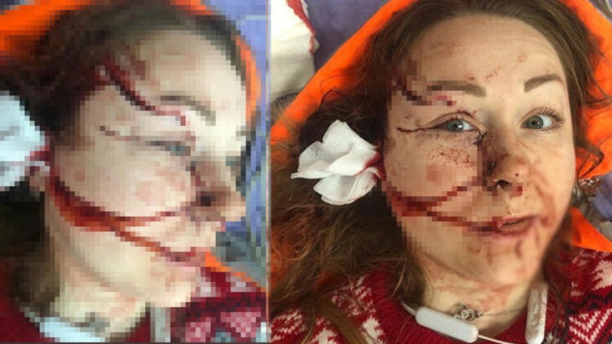 İstanbul’da eşinin falçatalı saldırısına uğradı: Yaşamak istiyorum
