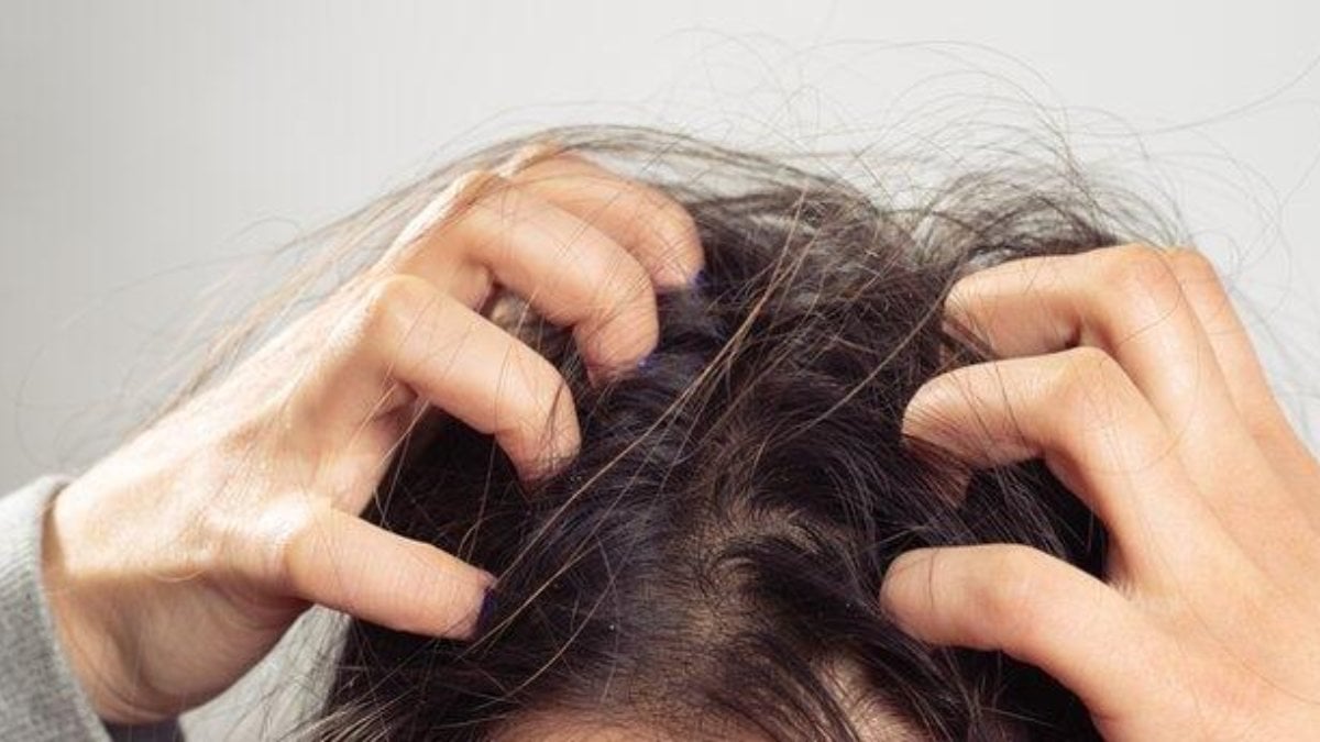Saç derisi kaşıntısına karşı 5 doğal çözüm