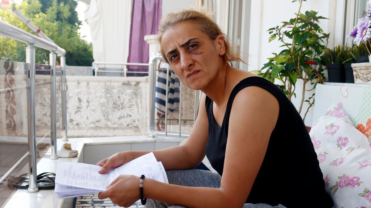 Antalya’da şiddet gören kadın: Ensemde ölüm kokusu alıyorum