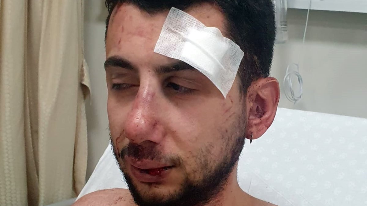 Konya'da kız arkadaşını korumak isterken dövüldü