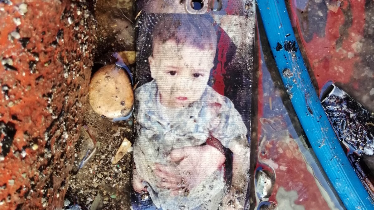 Konya'da yangında annesini kaybetti, iki eli bileklerinden kesildi