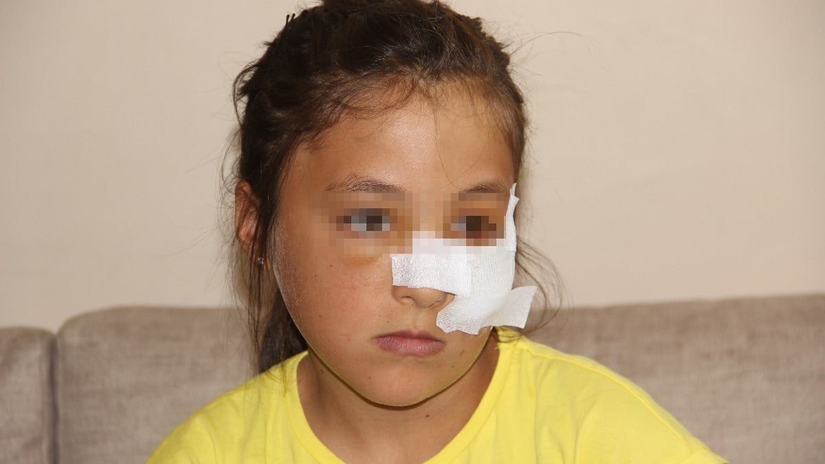 Erzurum'da 10 yaşındaki kuzenine demir boruyla saldırdı