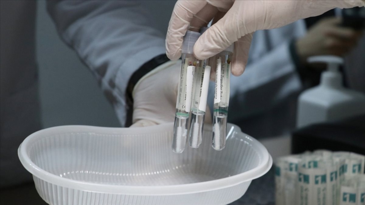 Ukrayna 4 ülkenin vatandaşlarına PCR testi zorunluluğu getirdi