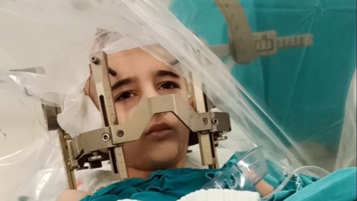 Elazığ'da çocuk hastaya uyanıkken beyin pili takıldı