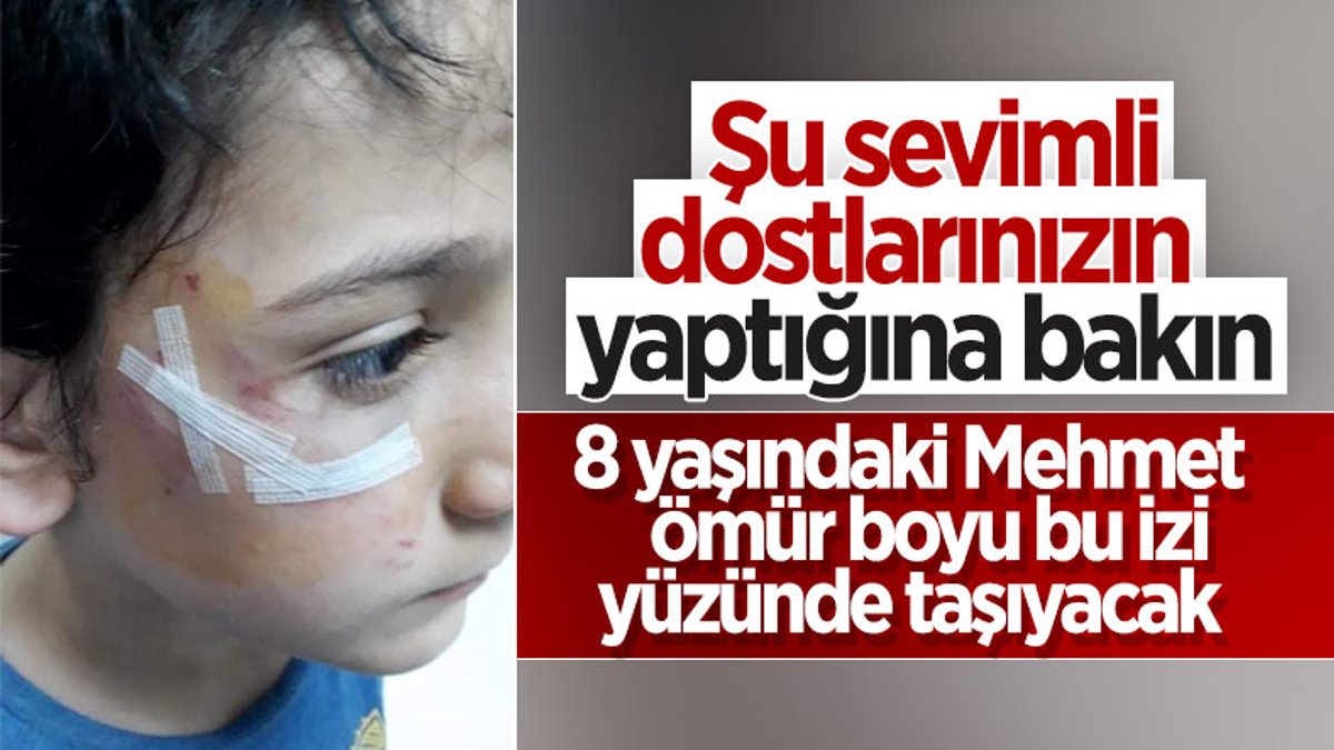 Bursa’da sokak köpeği 8 yaşındaki çocuğa saldırdı