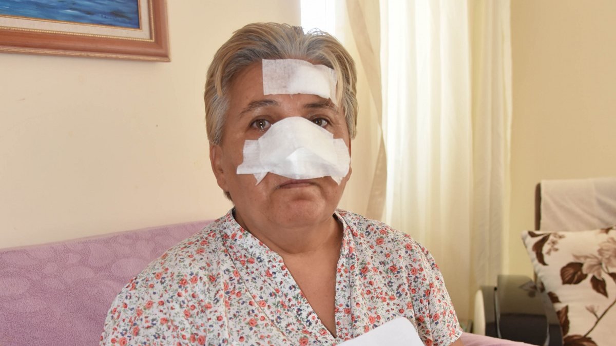 Antalya’da bir kadın, 2 pitbull köpeğinin saldırısına uğradı