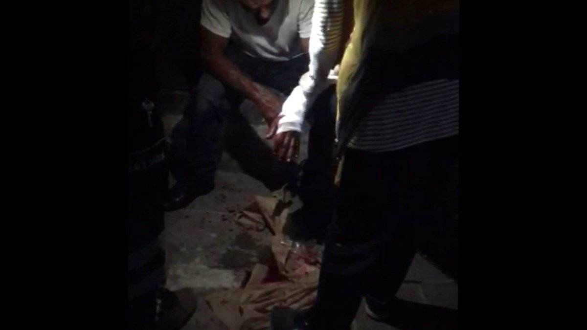 Kayseri'de uyardığı kadın tarafından bıçaklandı