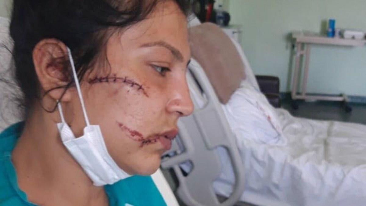 İzmir’de, 1 yaşındaki bebeğinin yanında dövülüp bıçaklandı