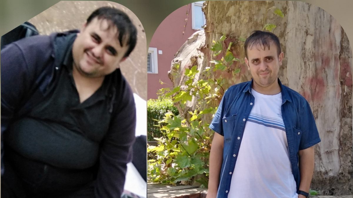 İstanbul’da ameliyat sonrası 57 kilo verdi, 10 yaş birden gençleşti
