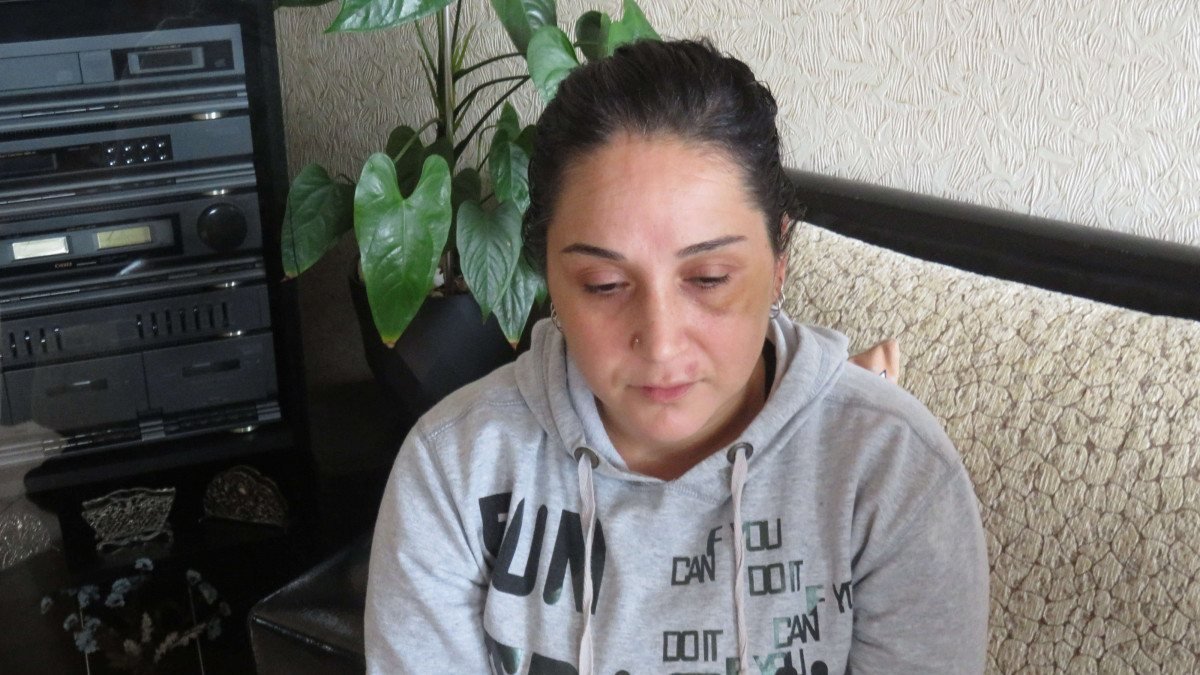 Üsküdar'da boşanma davası açılan şahıs, eşinin otomobilini yaktı