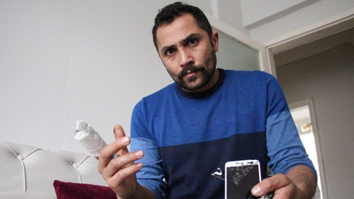 Erzurum'da patlayan powerbank parmağını kopardı