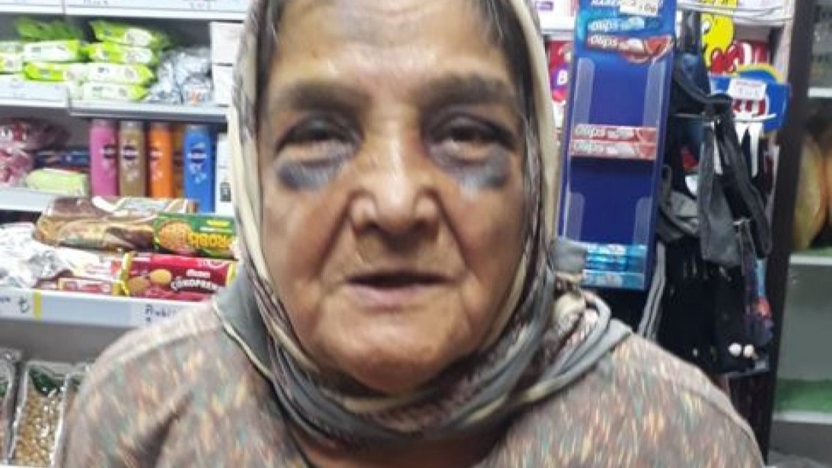 Kocaeli’de eşi tarafından dövülen 73 yaşındaki kadın, konukevine yerleştirildi