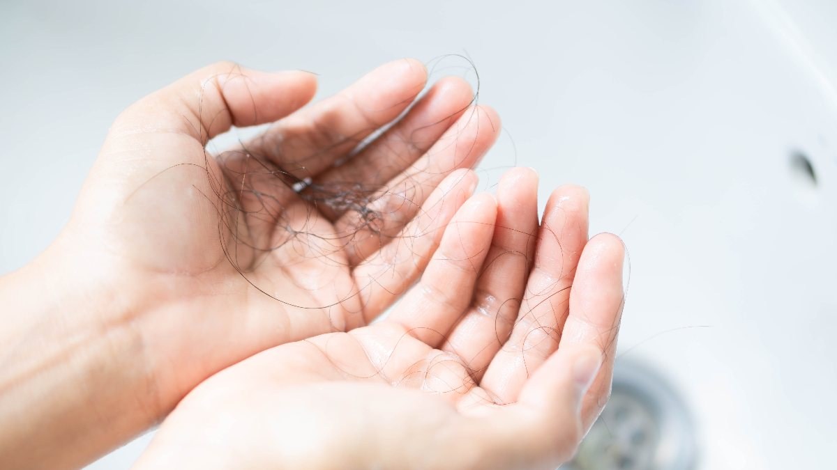 Saç dökülmelerini uygun tedaviyle durdurmak mümkün