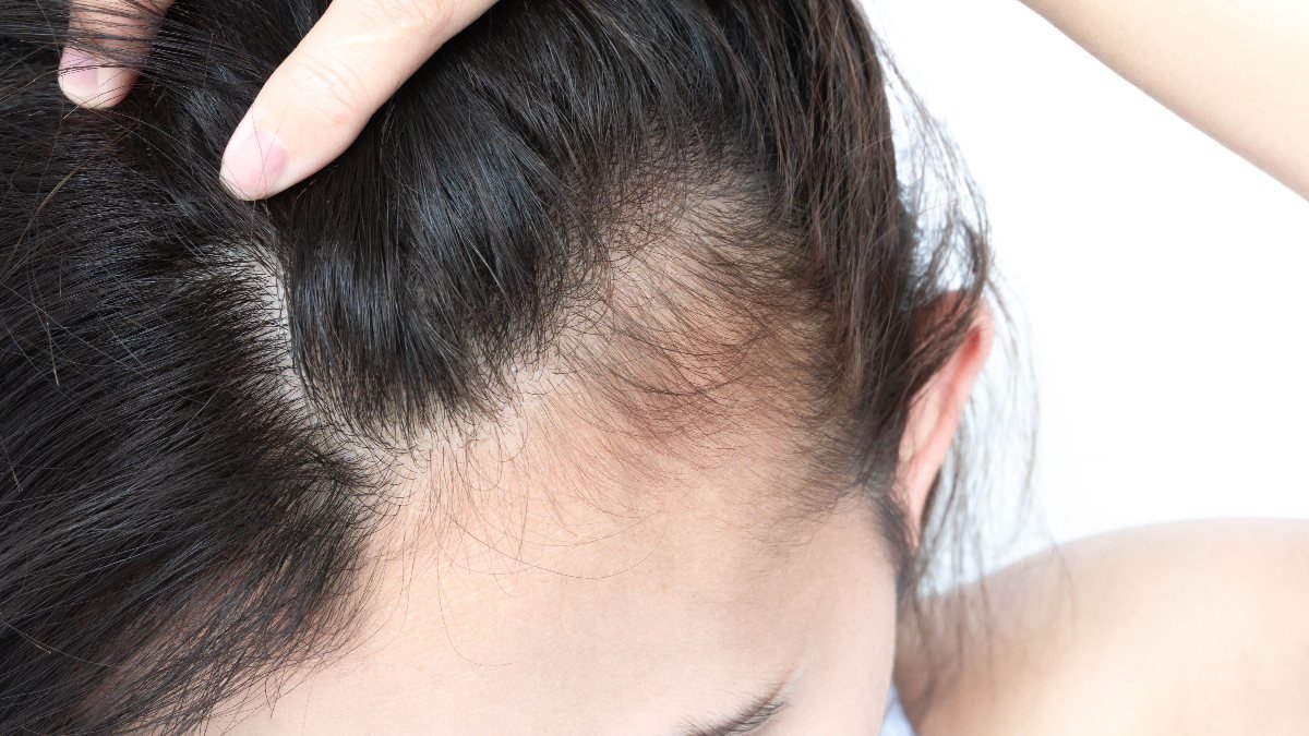 Saçınızda ciddi bir sağlık sorununu ortaya çıkarabilecek 5 belirti