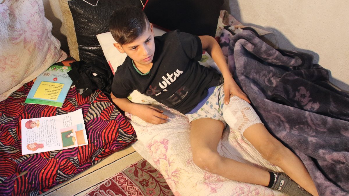 Ankara'da köpeğin saldırdığı çocuk: Bacağımdan et kopardılar