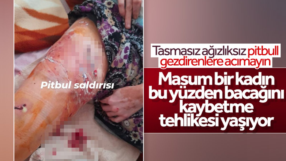 Antalya’da 45 yaşındaki kadın 2 pitbullun saldırısına uğradı