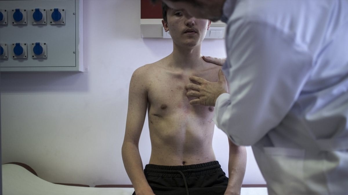 Ankara'da, kunduracı göğsü hastalığından kapalı ameliyat ile kurtuldu