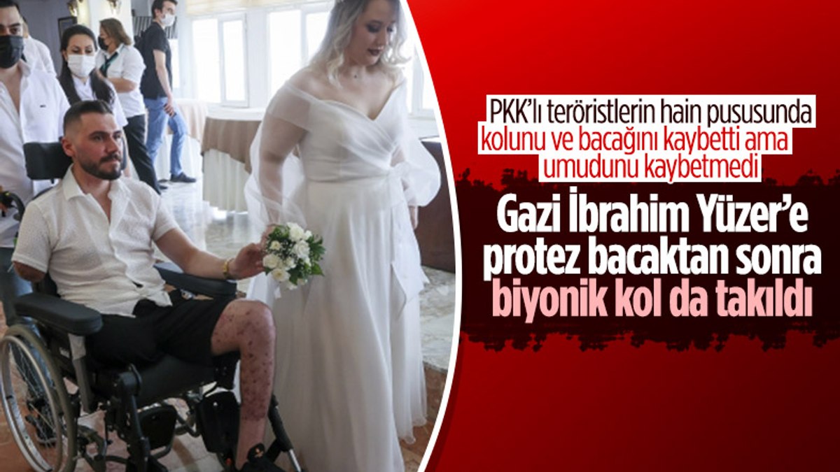 Pençe-Şimşek gazisi İbrahim Yüzerin biyonik kolu da takıldı