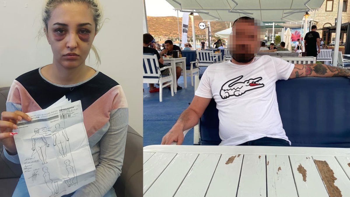 İzmir’de genç kadını eski sevgilisi darbetti
