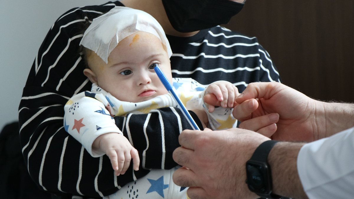 Gürcistanlı Niko bebek, beyin tümöründen Türkiye'de kurtuldu