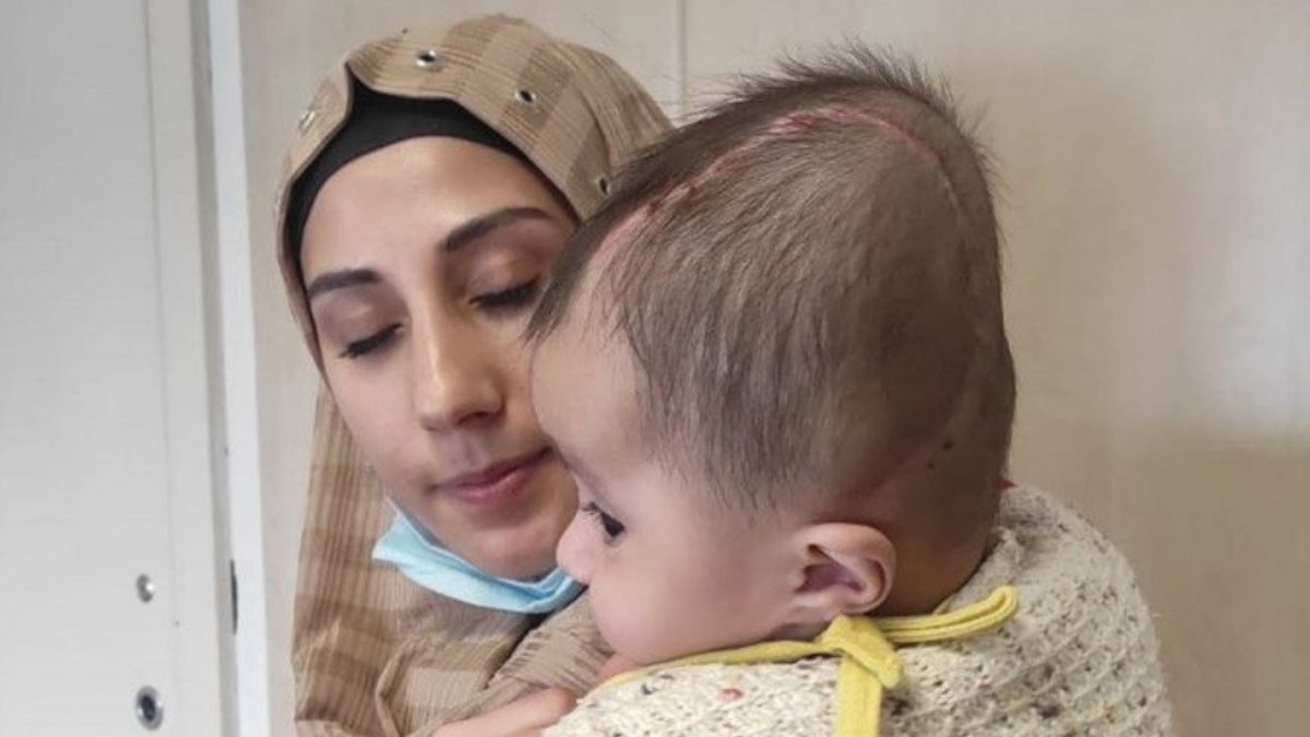 Ankara'da beyninden tümör alınan bebek sağlığına kavuştu