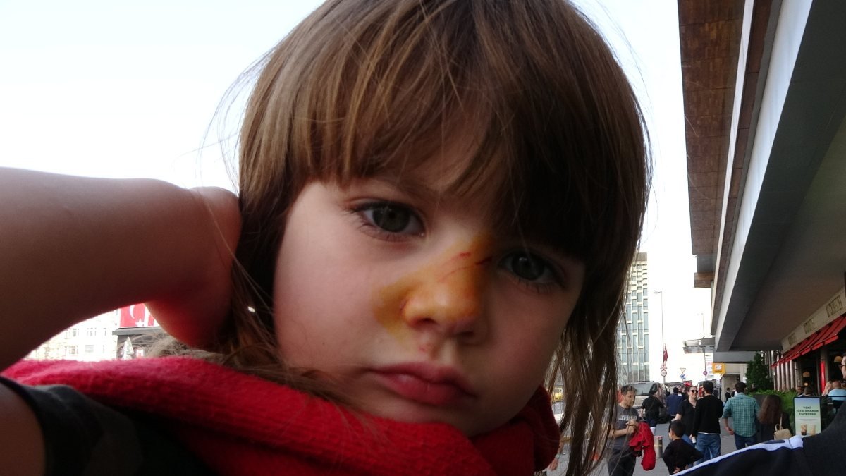 Taksim’de 3 yaşındaki çocuğa köpek saldırdı