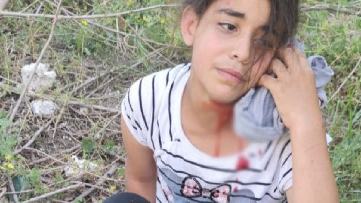 Mersin'de sokak köpeklerinin saldırdığı çocuk yaralandı