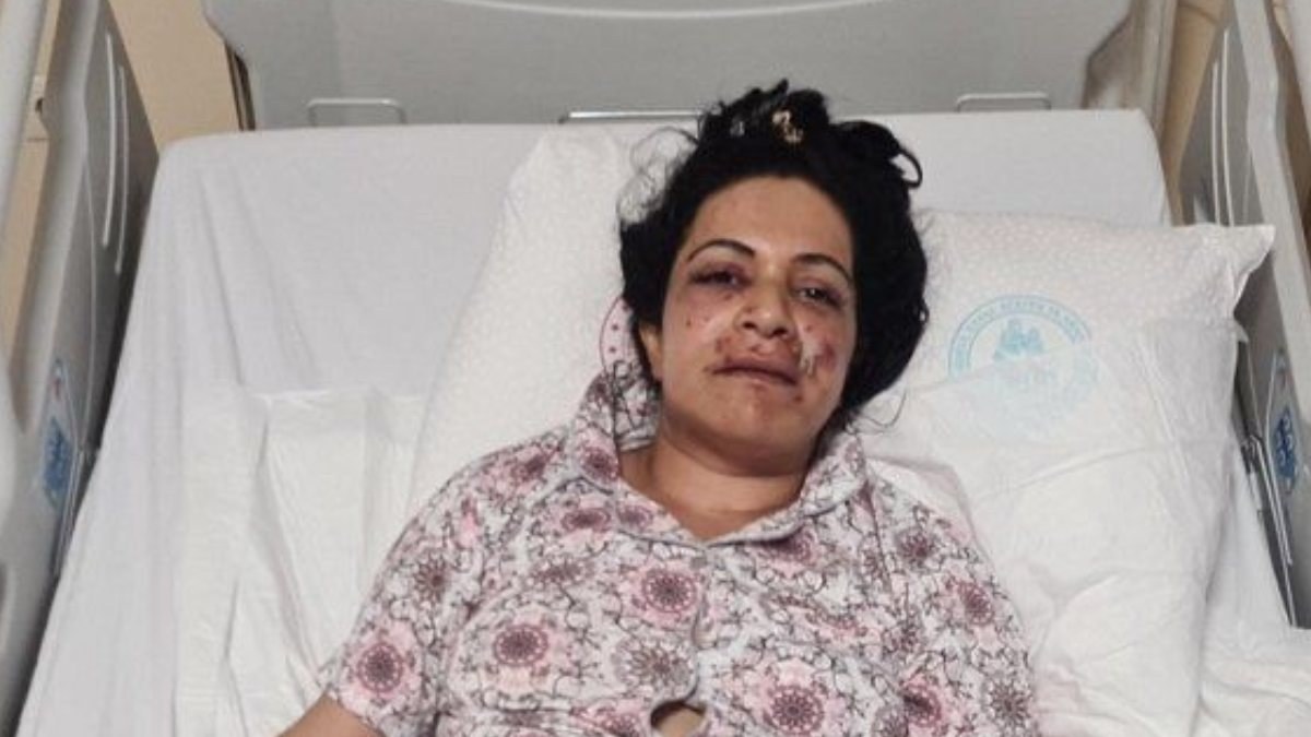 Sarıyer'de silahla ağzından vurulan kadın hastaneye kaldırıldı